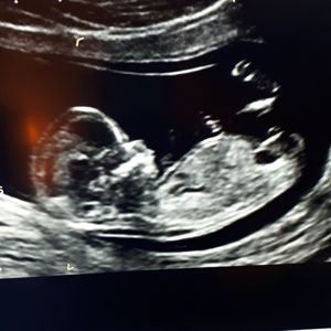 Meet your Posher, Mellissa